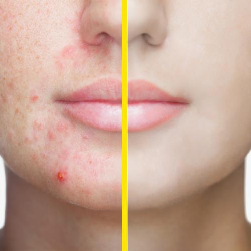 Revox Zitcare Teljes rutin box csomagajánlat