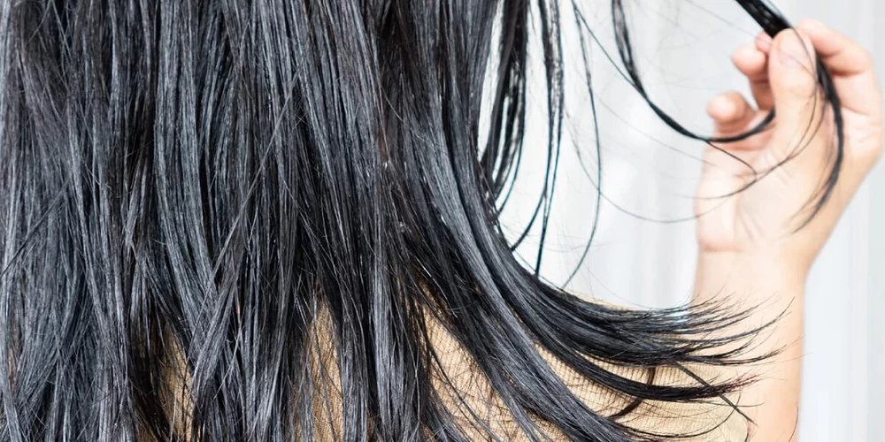 Gyorsan zsírosodó haj és fejbőr kezelése 