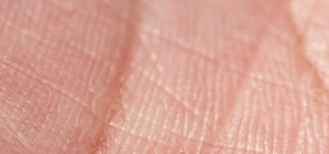 Az emberi bőr rétegei