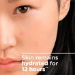 Kép 4/10 - Bioderma Sébium Sensitive Bőrnyugtató Arckrém 30 ml