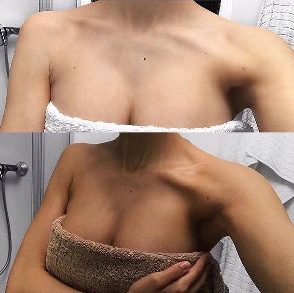 önbarnítás előtte utána