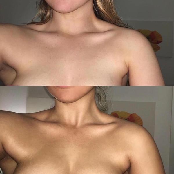 önbarnítás előtte utána